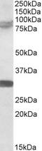 Tripartite Motif Containing 2 antibody, orb18436, Biorbyt, Western Blot image 