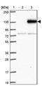 AXL Receptor Tyrosine Kinase antibody, NBP2-38345, Novus Biologicals, Western Blot image 