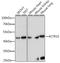 Actin Related Protein 10 antibody, A15867, ABclonal Technology, Western Blot image 