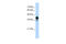 Heterogeneous Nuclear Ribonucleoprotein C (C1/C2) antibody, 29-477, ProSci, Enzyme Linked Immunosorbent Assay image 