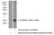 S100 Calcium Binding Protein A16 antibody, 11456-1-AP, Proteintech Group, Western Blot image 