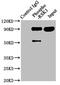 Ribosomal Protein S6 Kinase A1 antibody, CSB-RA618984A380phHU, Cusabio, Immunoprecipitation image 