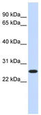 CTD Nuclear Envelope Phosphatase 1 antibody, TA341969, Origene, Western Blot image 
