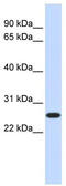 CTD Nuclear Envelope Phosphatase 1 antibody, TA341969, Origene, Western Blot image 