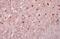 ISL LIM Homeobox 2 antibody, GTX129375, GeneTex, Immunohistochemistry paraffin image 