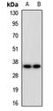 Endomucin antibody, orb412754, Biorbyt, Western Blot image 