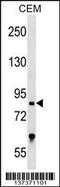 Transcription Factor 25 antibody, TA324616, Origene, Western Blot image 
