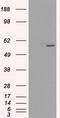 Cytochrome P450 Family 2 Subfamily E Member 1 antibody, LS-C114815, Lifespan Biosciences, Western Blot image 