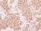 Adaptor Related Protein Complex 2 Subunit Beta 1 antibody, PA5-29517, Invitrogen Antibodies, Immunohistochemistry frozen image 