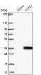 Potassium Channel Tetramerization Domain Containing 4 antibody, NBP1-92045, Novus Biologicals, Western Blot image 