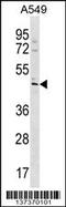 TBC1 Domain Family Member 20 antibody, 60-032, ProSci, Western Blot image 