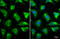 Translocase Of Outer Mitochondrial Membrane 22 antibody, GTX134799, GeneTex, Immunofluorescence image 