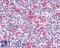C-C Motif Chemokine Receptor 9 antibody, LS-A961, Lifespan Biosciences, Immunohistochemistry paraffin image 