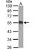 Eukaryotic Translation Initiation Factor 5 antibody, NBP2-16311, Novus Biologicals, Western Blot image 