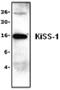 KiSS-1 Metastasis Suppressor antibody, GTX59777, GeneTex, Western Blot image 