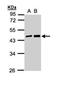 Melanoma-associated antigen 11 antibody, NBP1-31210, Novus Biologicals, Western Blot image 