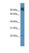 Mitochondrial Ribosomal Protein L49 antibody, NBP1-68932, Novus Biologicals, Western Blot image 