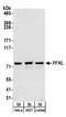 Phosphofructokinase, Liver Type antibody, A304-320A, Bethyl Labs, Western Blot image 