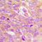 Inhibitor Of Nuclear Factor Kappa B Kinase Subunit Beta antibody, GTX55109, GeneTex, Immunohistochemistry paraffin image 