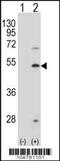 Farnesyl-Diphosphate Farnesyltransferase 1 antibody, 61-388, ProSci, Western Blot image 