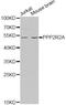 Protein Phosphatase 2 Regulatory Subunit Balpha antibody, MBS127061, MyBioSource, Western Blot image 