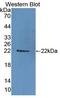 Damage Specific DNA Binding Protein 2 antibody, LS-C373930, Lifespan Biosciences, Western Blot image 