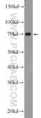 Thiamine transporter 2 antibody, 13407-1-AP, Proteintech Group, Western Blot image 