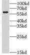 Lymphocyte Antigen 6 Family Member G6F antibody, FNab04898, FineTest, Western Blot image 