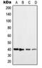 Histamine Receptor H2 antibody, orb214058, Biorbyt, Western Blot image 