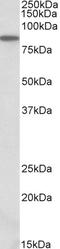 Aldehyde Dehydrogenase 18 Family Member A1 antibody, EB10433, Everest Biotech, Western Blot image 