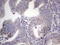 Plasminogen Activator, Urokinase antibody, LS-C339513, Lifespan Biosciences, Immunohistochemistry frozen image 