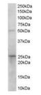 15-Hydroxyprostaglandin Dehydrogenase antibody, orb18932, Biorbyt, Western Blot image 