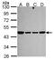 NADH:Ubiquinone Oxidoreductase Core Subunit S2 antibody, PA5-22364, Invitrogen Antibodies, Western Blot image 