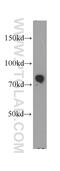 Myristoylated Alanine Rich Protein Kinase C Substrate antibody, 20661-1-AP, Proteintech Group, Western Blot image 