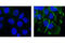 Catenin Delta 1 antibody, 2911S, Cell Signaling Technology, Immunocytochemistry image 