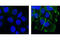 p120 catenin antibody, 2911S, Cell Signaling Technology, Immunocytochemistry image 