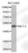 Solute Carrier Family 16 Member 3 antibody, A1554, ABclonal Technology, Western Blot image 