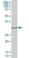 Eukaryotic Translation Initiation Factor 2B Subunit Alpha antibody, H00001967-B01P, Novus Biologicals, Western Blot image 