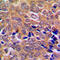 ABL Proto-Oncogene 2, Non-Receptor Tyrosine Kinase antibody, GTX54914, GeneTex, Immunohistochemistry paraffin image 