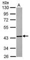 Glutaredoxin 3 antibody, GTX118893, GeneTex, Western Blot image 