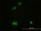 Calcium/Calmodulin Dependent Protein Kinase IV antibody, H00000814-M01, Novus Biologicals, Immunocytochemistry image 
