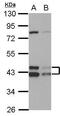 DnaJ Heat Shock Protein Family (Hsp40) Member A3 antibody, PA5-27226, Invitrogen Antibodies, Western Blot image 