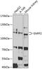 Ectonucleotide Pyrophosphatase/Phosphodiesterase 2 antibody, 18-686, ProSci, Western Blot image 