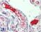 Tubulin Beta 3 Class III antibody, 43-094, ProSci, Western Blot image 