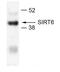 Sirtuin 6 antibody, 27-589, ProSci, Western Blot image 
