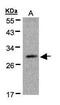 Kallikrein Related Peptidase 2 antibody, PA5-27208, Invitrogen Antibodies, Western Blot image 