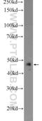 ST3 Beta-Galactoside Alpha-2,3-Sialyltransferase 3 antibody, 24925-1-AP, Proteintech Group, Western Blot image 