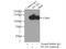 Melanoma Cell Adhesion Molecule antibody, 17564-1-AP, Proteintech Group, Immunoprecipitation image 