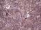 Protein Kinase D3 antibody, NBP2-45390, Novus Biologicals, Immunohistochemistry paraffin image 