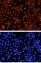 GATA Binding Protein 3 antibody, MAB26051, R&D Systems, Immunocytochemistry image 